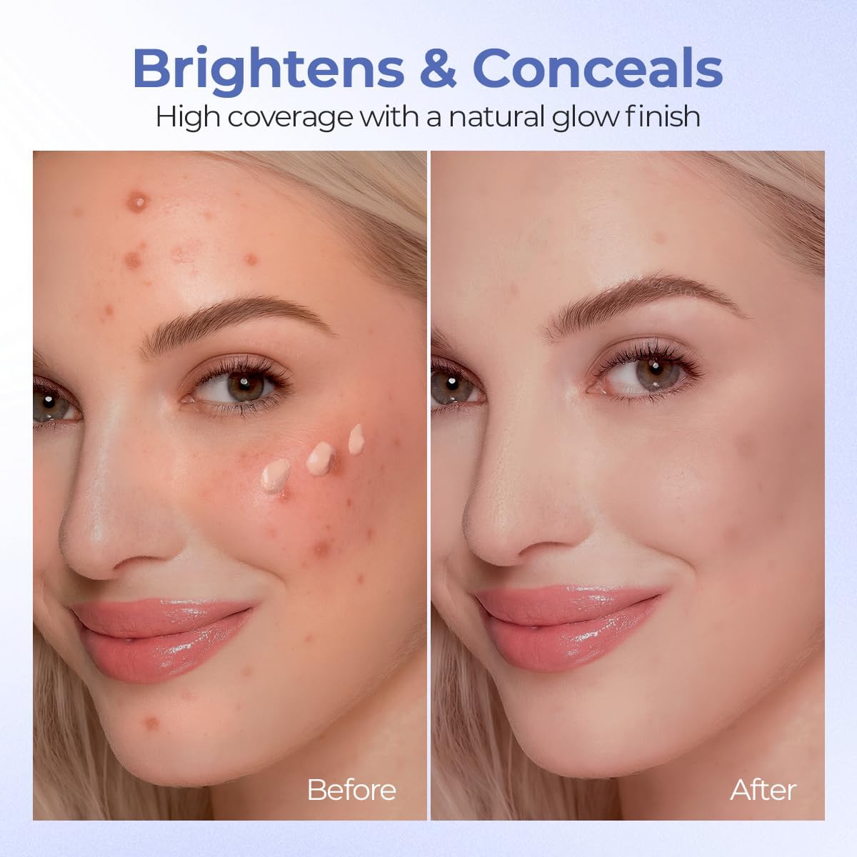 SACE LADY Corretivo De Alta Cobertura, Sérum Iluminador Para Olhos, Manchas, Vermelhidão E Olheiras, Com Retinol E Ácido Hialurônico, Hidratação 24 Horas (03 Light Natural) - Imagem 3