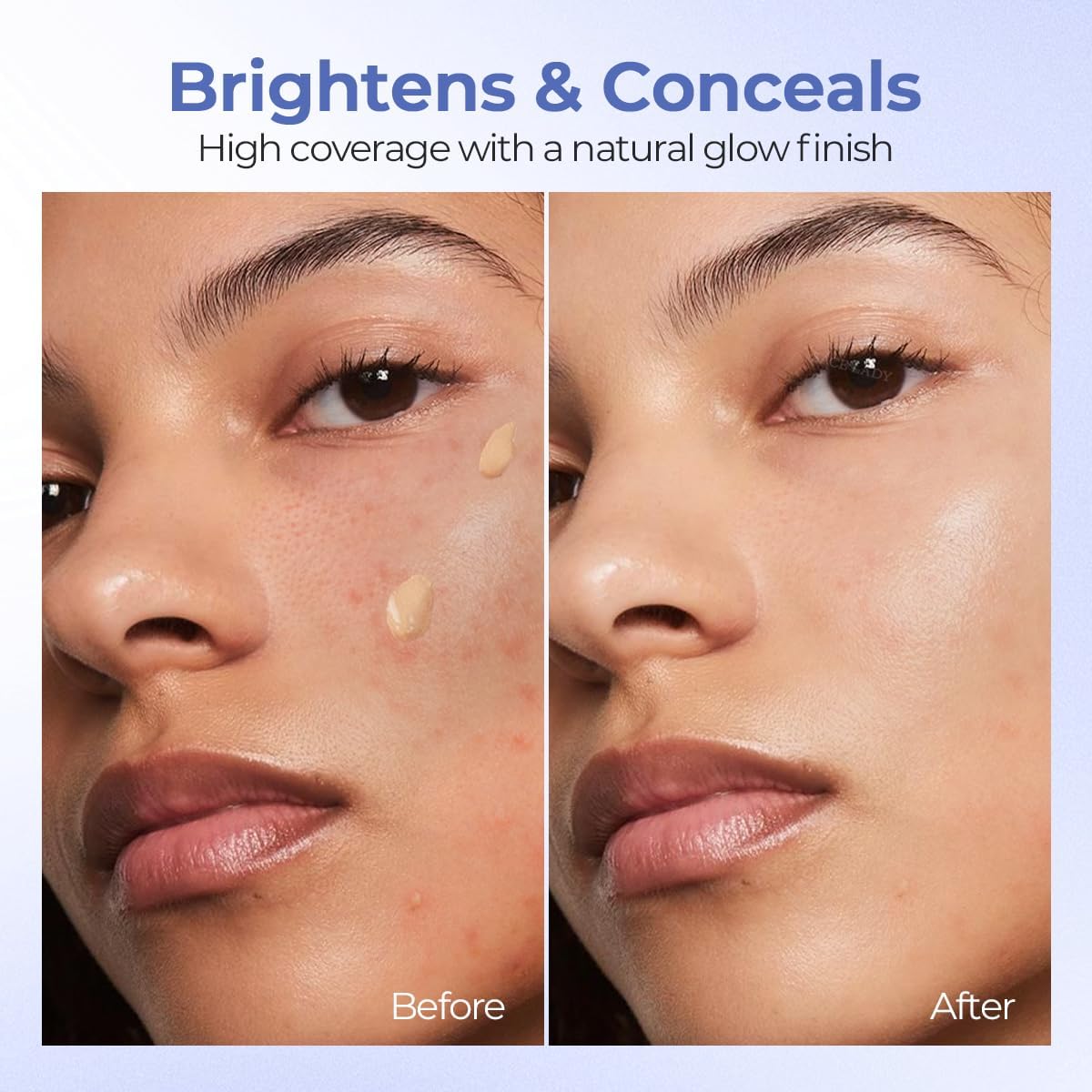 SACE LADY Corretivo De Alta Cobertura, Sérum Iluminador Para Olhos, Manchas, Vermelhidão E Olheiras, Com Retinol E Ácido Hialurônico, Hidratação 24 Horas (04 Natural) - Imagem 3