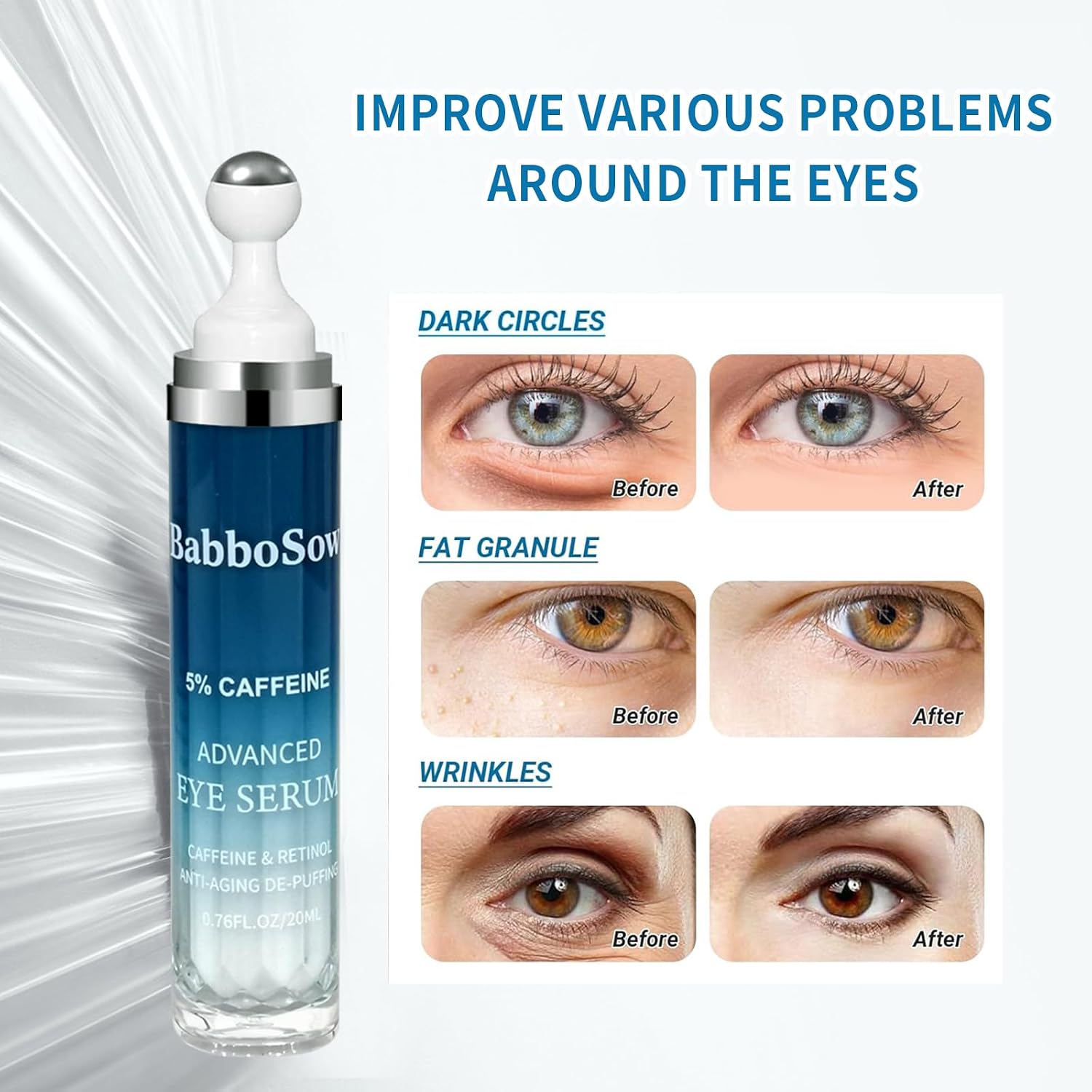 Creme para os olhos com 5% de cafeína e rolo de 360°, 22,48 ml | Para olheiras, bolsas fofas e linhas finas. Enriquecido com palmitato de retinila e uma bola de massagem com rolo. - Imagem 3